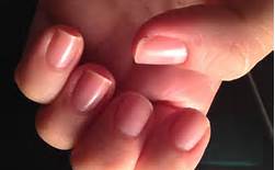 Unhas naturalmente brilhantes podem ser sinal de oleosidade extra...